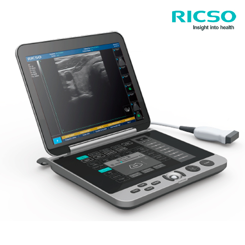 Ecógrafo Ricso Ultramate U3